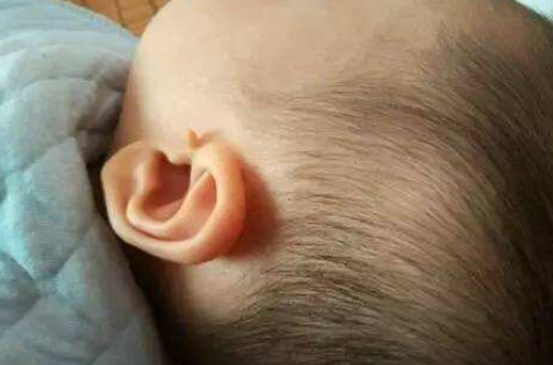 耳朵拴马桩图片