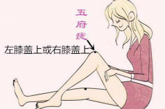 女人左膝盖上有痣好吗