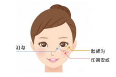 有印第安纹的面相好吗