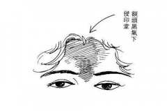 印堂发黑如何快速化解